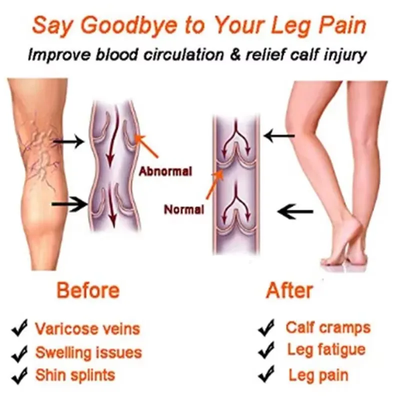 Women Compression Socks Slimmi - Compression Sleeve Calf review and price